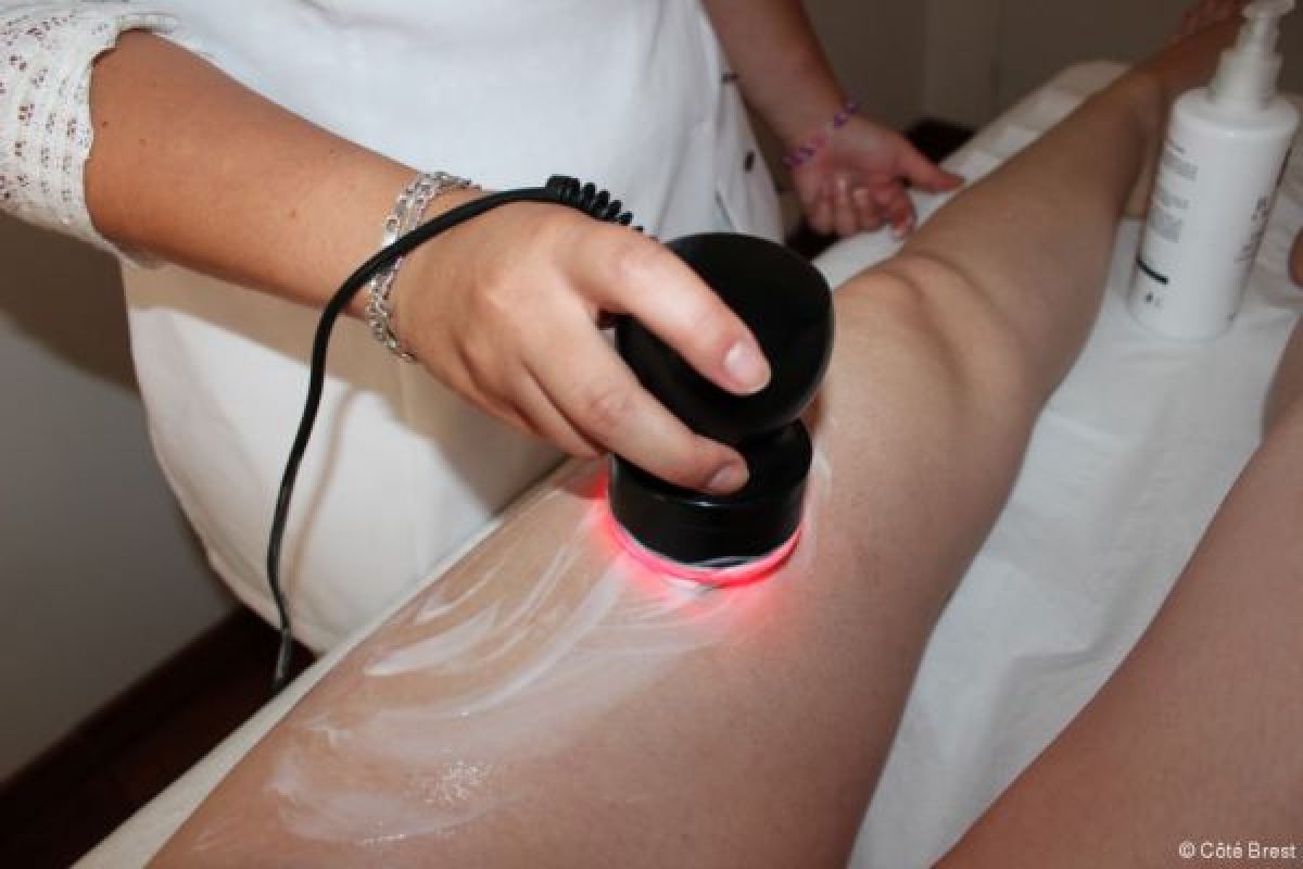 Lipocavitation à Toulouse (31) Par Sarah - Estheca