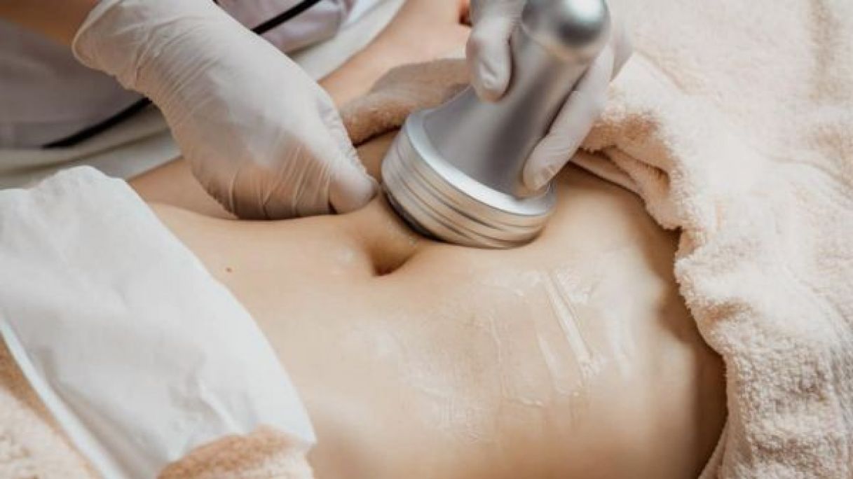 Lipocavitation à Paris (75) Par Carla - Estheca