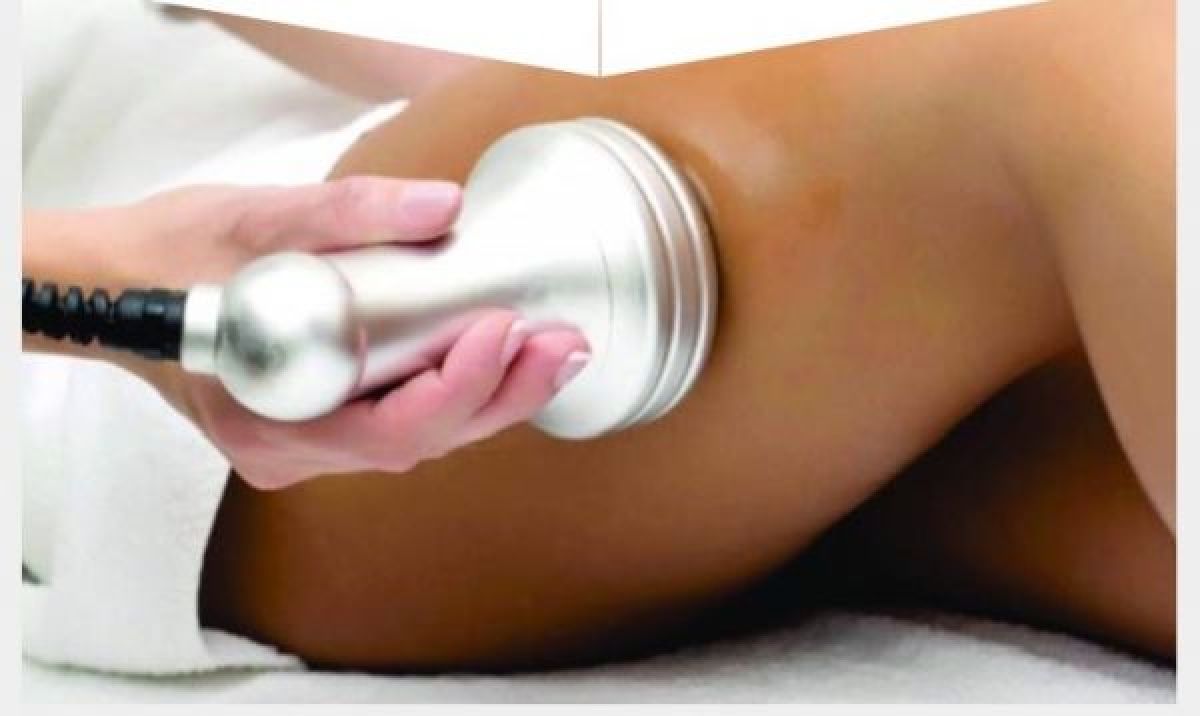 Lipocavitation  à Lille (59) Par Isabelle - Estheca