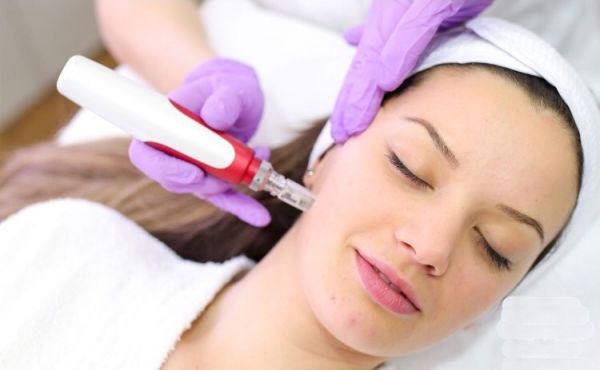 À Nice | Microneedling / BB GLOW  | Les meilleures esthéticiennes