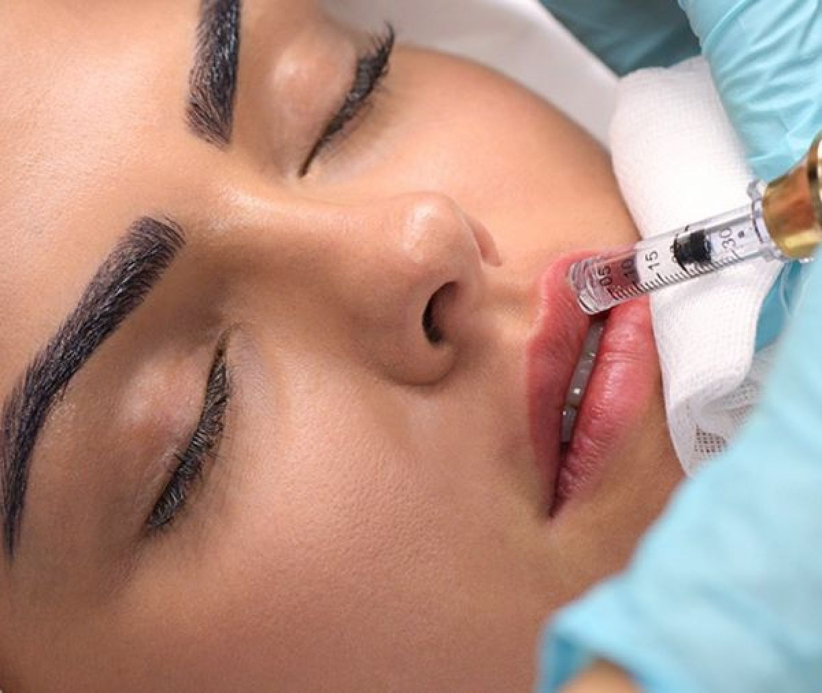 Hyaluron pen à Sotteville-lès-Rouen (76) Par Mélodie - Estheca