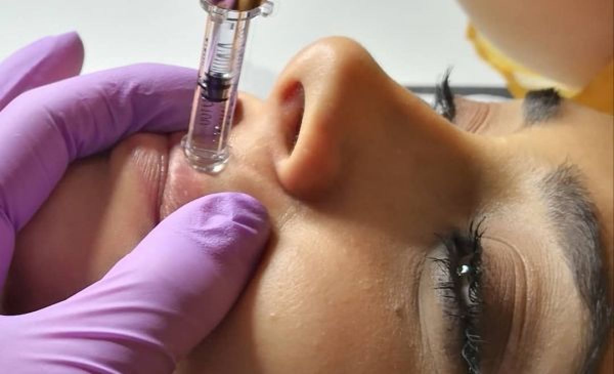 Hyaluron pen à Saint-Julien-les-Rosiers (30) Par Saïda - Estheca