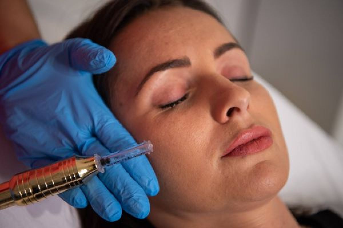 Augmentation lèvres Hyaluron pen à Chancelade (24) Par Mélanie - Estheca