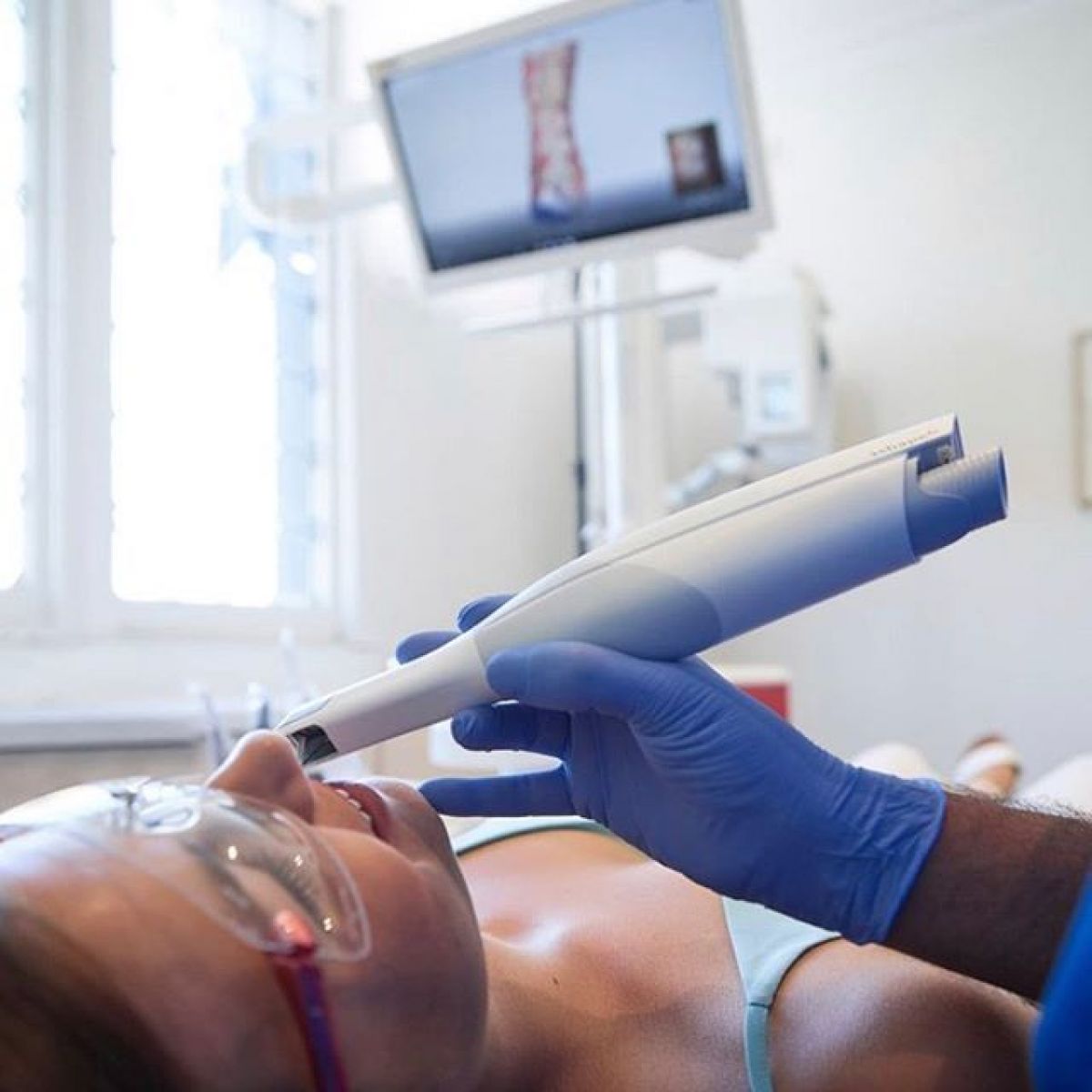 Blanchiment dentaire Pro à Montreuil (93) Par Mélanie - Estheca
