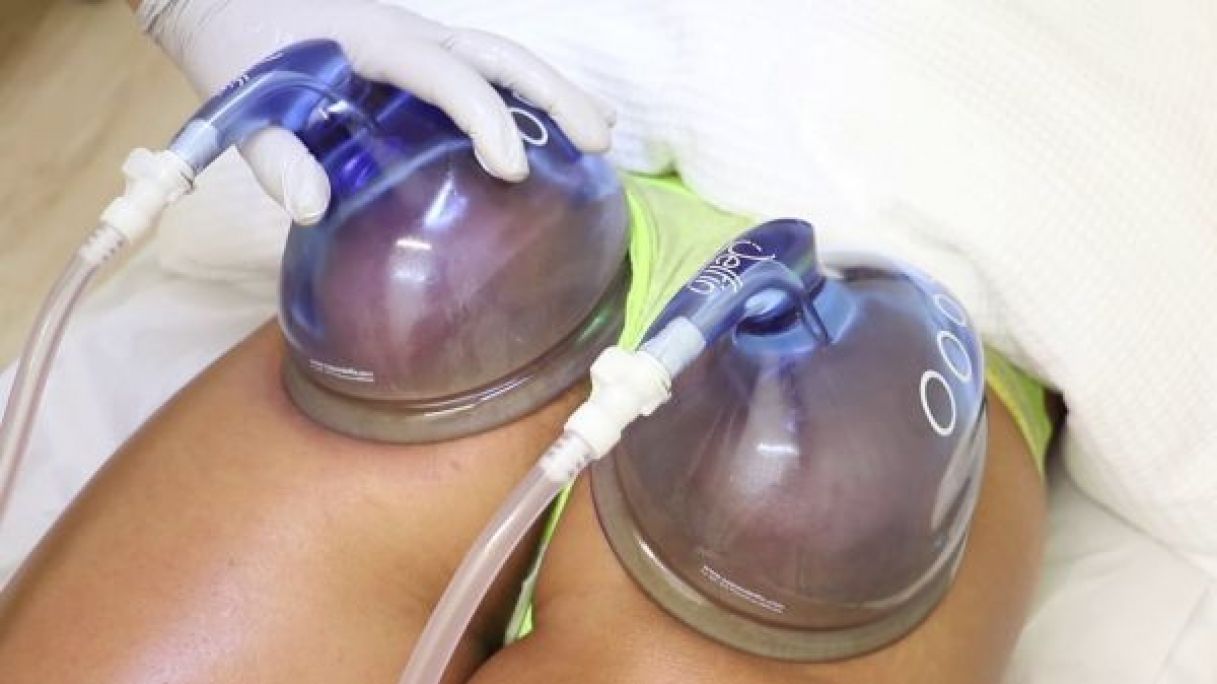 Lifting Colombien  à Lille (59) Par Hajar - Estheca