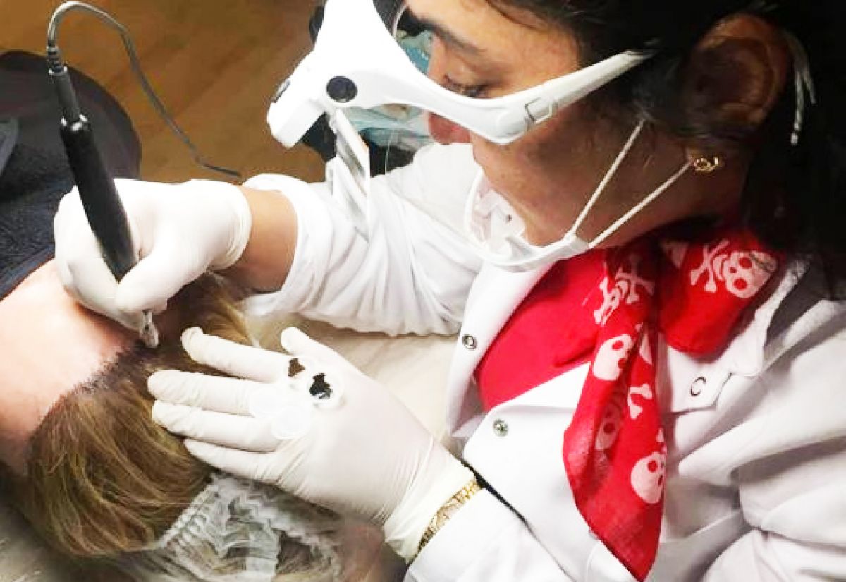 Micropigmentation du cuir chevelu à Toulouse (31) Par Hager - Estheca