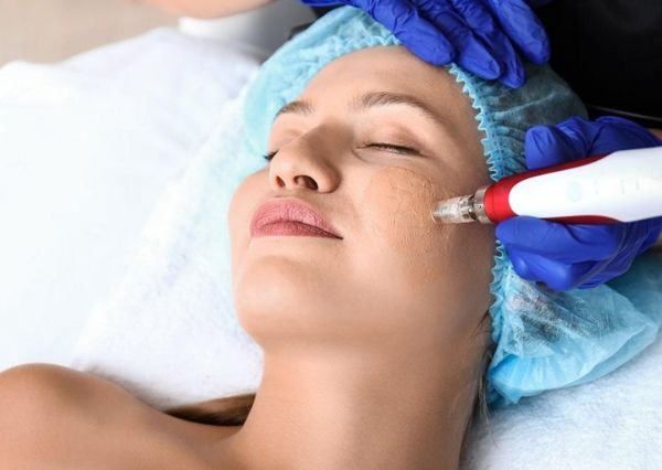À Grenoble | Microneedling zéro tache correction cernes  | Les meilleures esthéticiennes