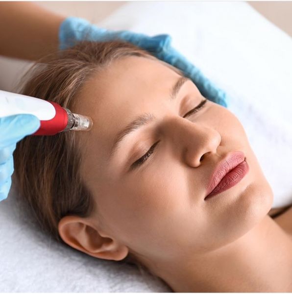 À Troyes | Microneedling BB GLOW | Les meilleures esthéticiennes