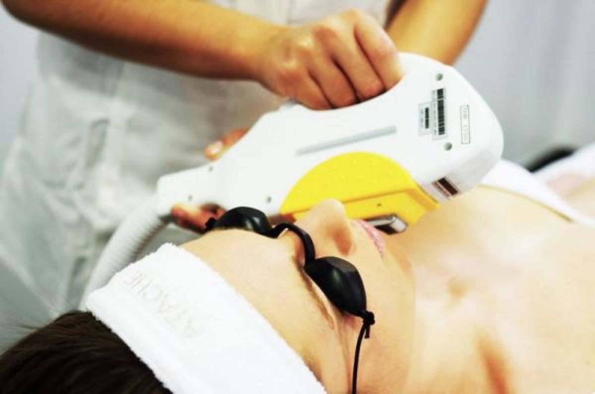Épilation définitive lumière pulsée à Lille (59) Par Alicia - Estheca