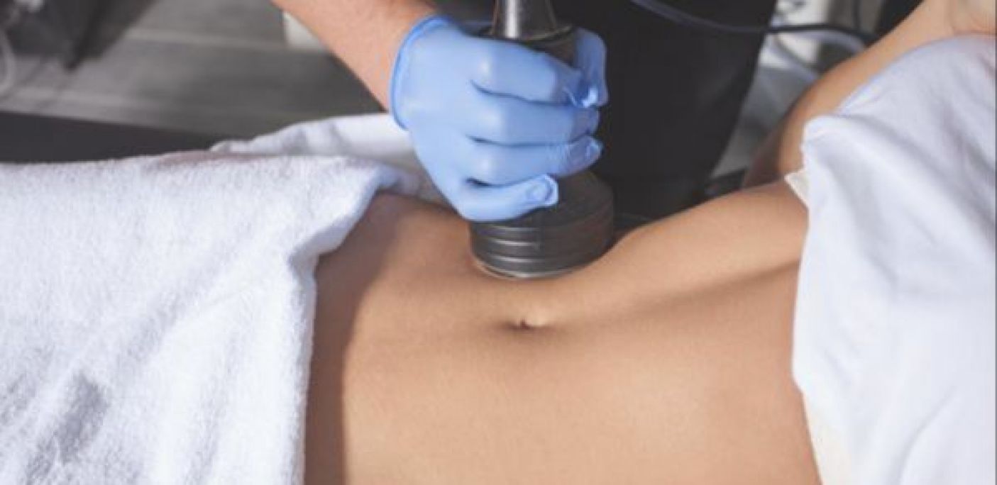 Radiofréquence / Lipocavitation à Fréjus (83) Par Gwendoline - Estheca