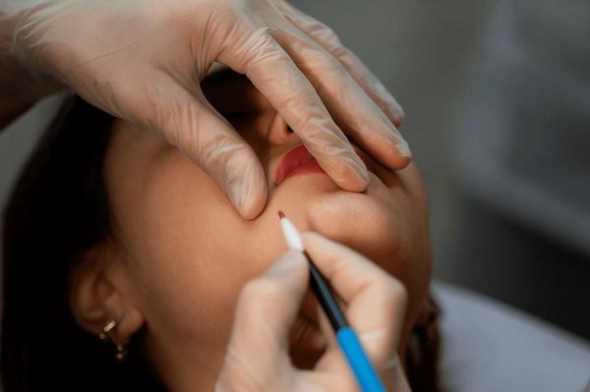 Électrolyse / thermolyse à Valenciennes (59) Par Wafa - Estheca