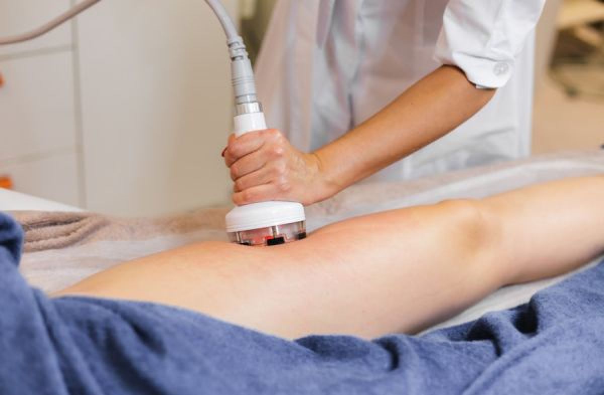 Lipocavitation / Radiofréquence  à Osny (95) Par Sabrina - Estheca