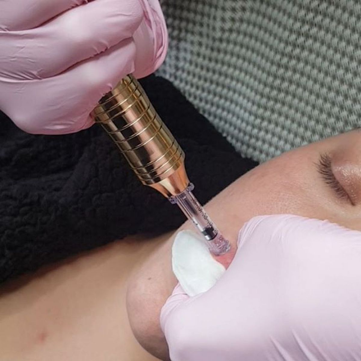 Hyaluron pen à Ivry-sur-Seine (94) Par Gwendoline - Estheca