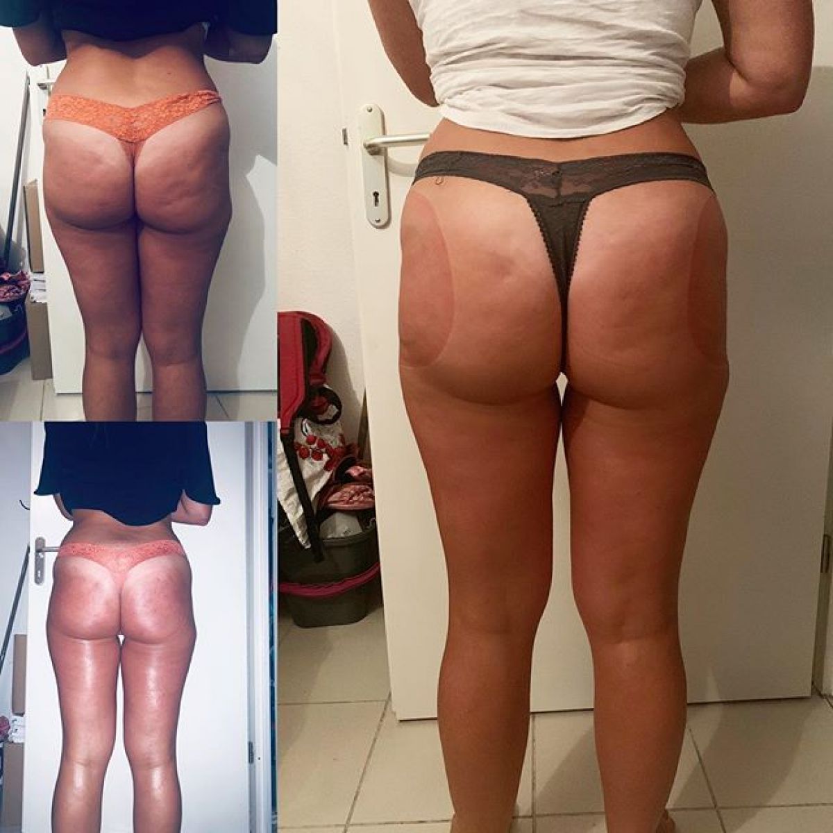 Lifting Colombien à Asnières-sur-Seine (92) Par Caroline - Estheca