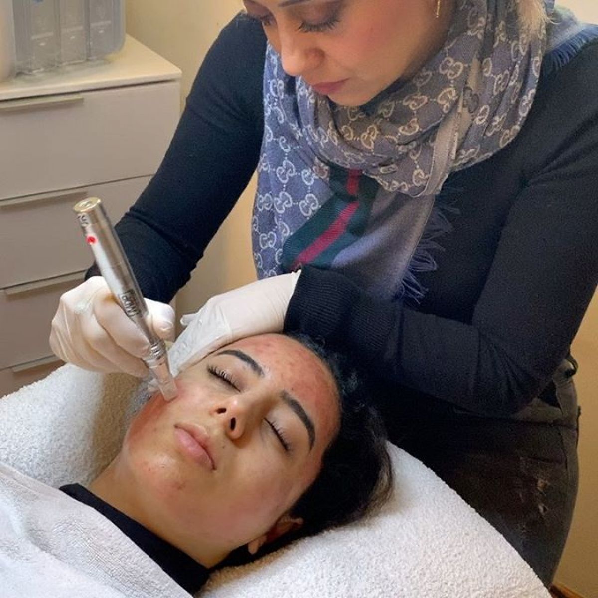 MicroNeedling BB Glow à Vitrolles (13) Par Caroline - Estheca