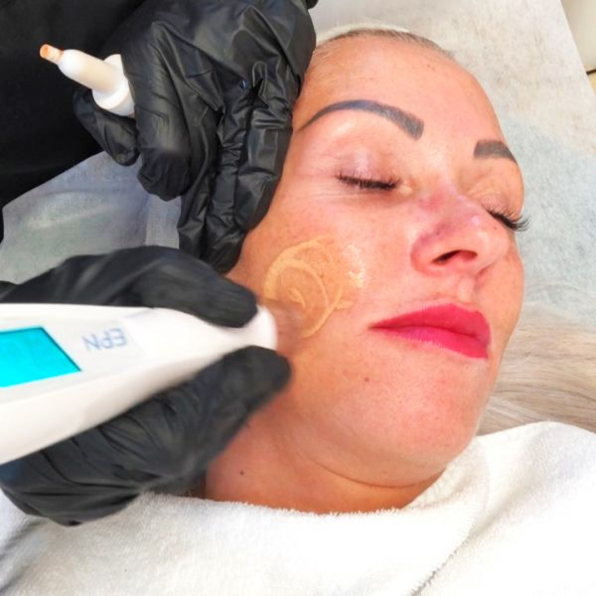 MicroNeedling BB Glow à Cergy (95) Par Hassia - Estheca