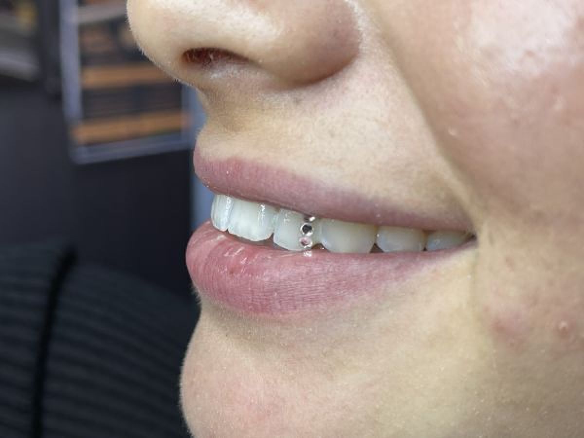 Strass dentaire à Noisy-le-Grand (93) Par Kenza - Estheca
