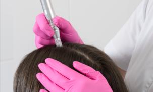 À Argenteuil | Mesotherapie cheveux | Les meilleures esthéticiennes