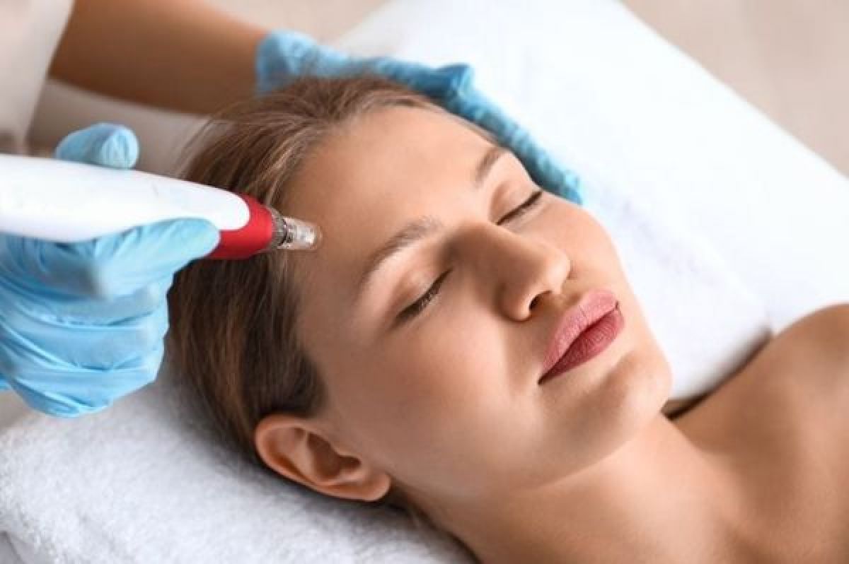 Microneedling / anti Marque / anti Rides / traite les pores à Paris (75) Par Fonseca - Estheca