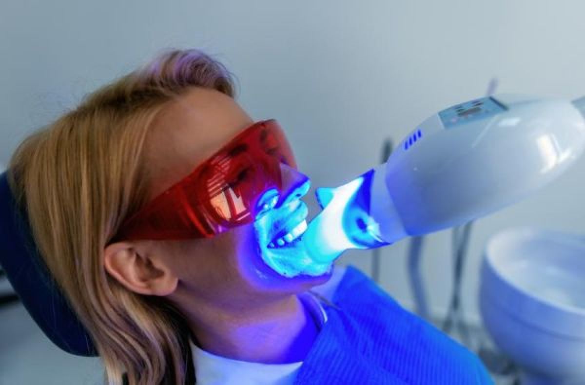 Blanchiment dentaire à Bagneux (92) Par Sarah - Estheca