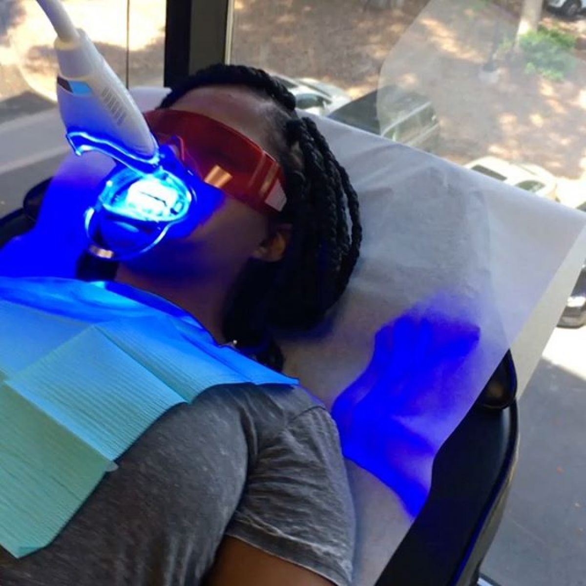 Blanchiment dentaire à Antony (92) Par Caroline - Estheca