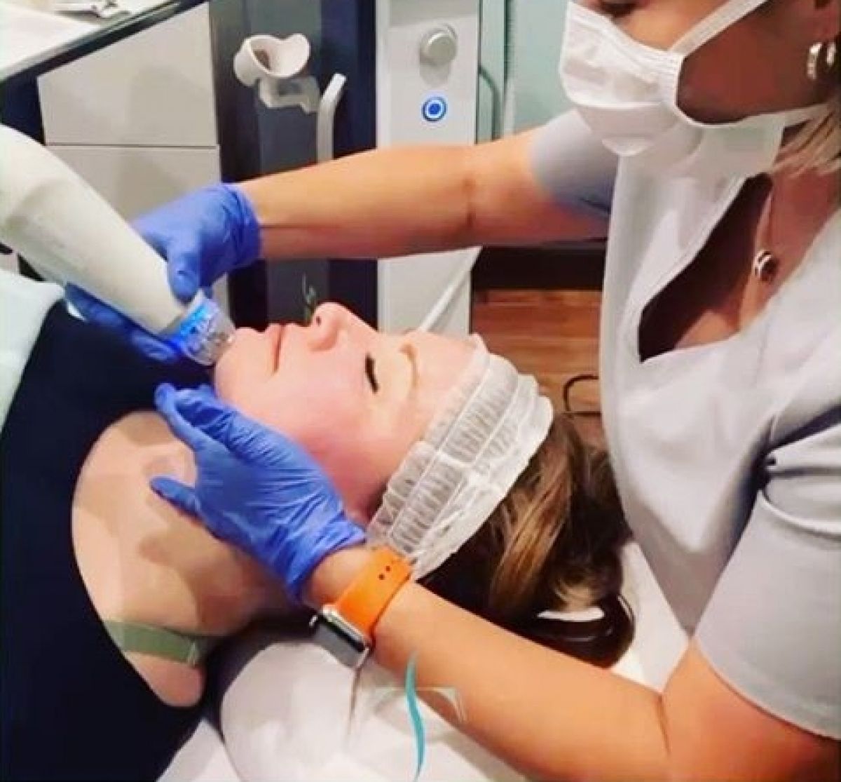 MicroNeedling BB Glow à Laval (53) Par Morgane - Estheca