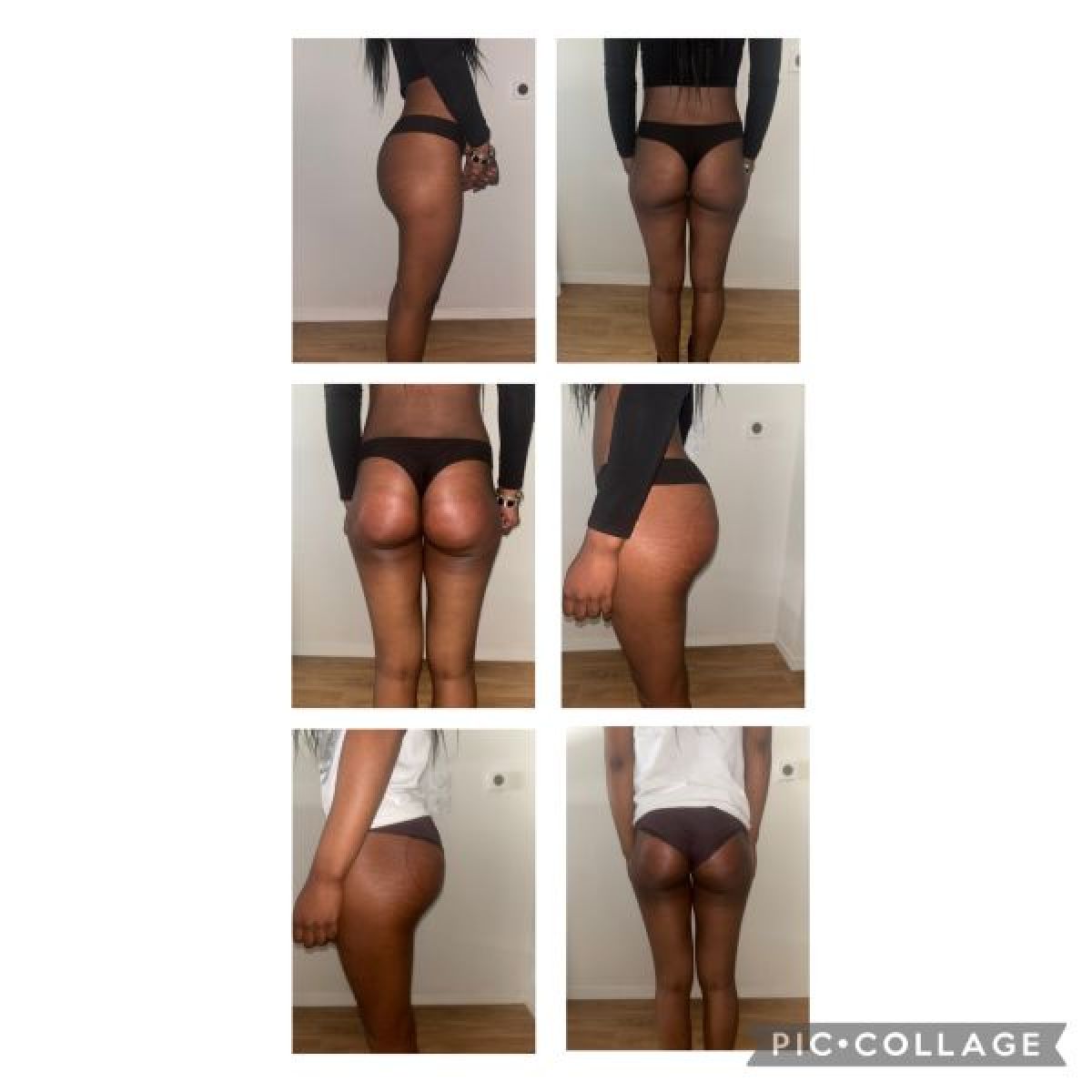 Lifting Colombien à Dijon (21) Par Charlotte - Estheca