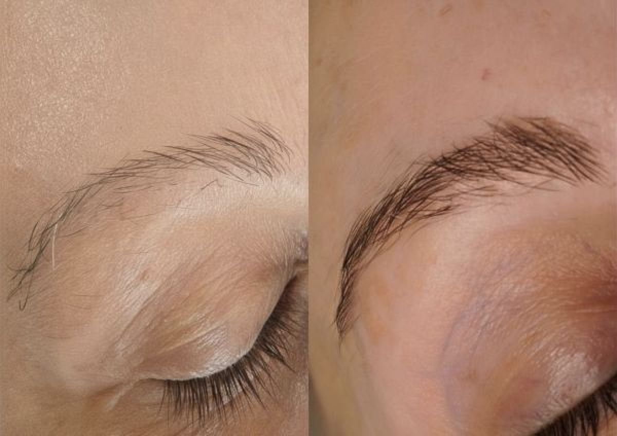 EXO LUX – La Révolution Exosomes + PDRN pour une Peau, des Cheveux et des Sourcils Régénérés à Tourcoing (59) Par Fatima - Estheca
