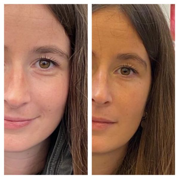 À Nantes | Soin bronzant activateur de mélanine | Les meilleures esthéticiennes