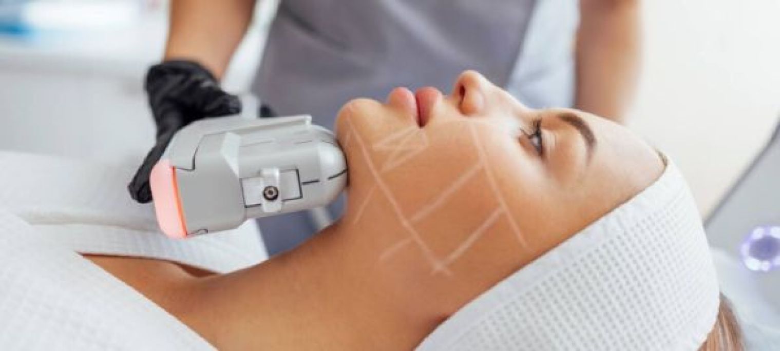 HIFU lifting sans chirurgie à Mulhouse (68) Par Dina - Estheca