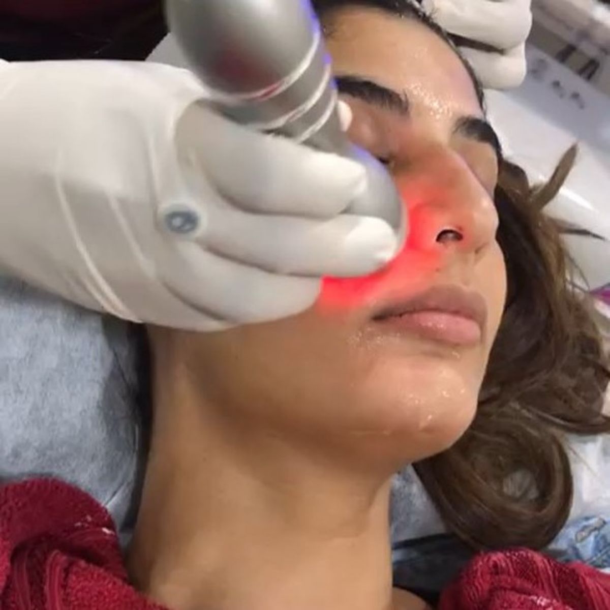 Radio fréquence et Lipocavitation à Schiltigheim (67) Par Adeline - Estheca
