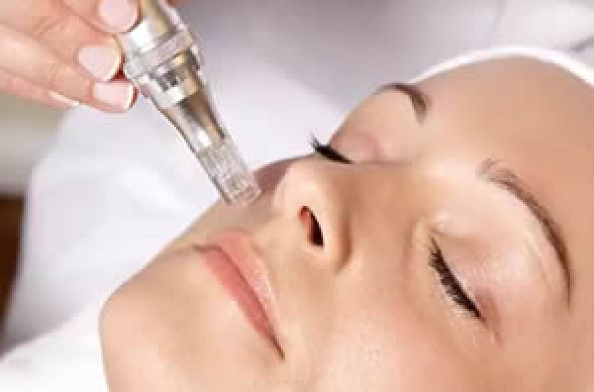 Microneedling à Toulon (83) Par Solenne - Estheca