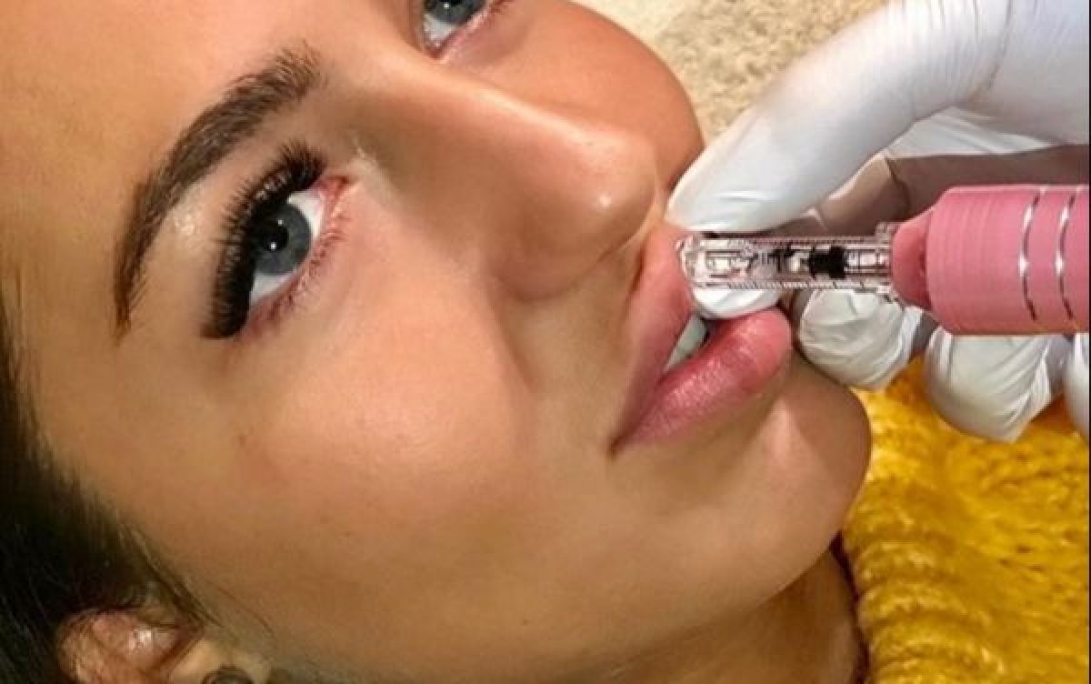Hyaluron pen à Romainville (93) Par Samya - Estheca