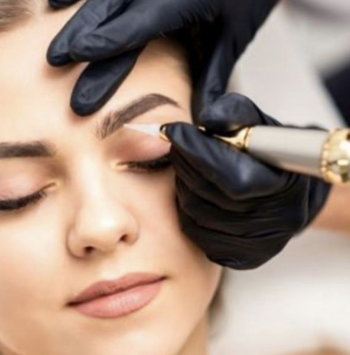 Détatouage NanoRemoval à Béziers (34) Par Marina - Estheca