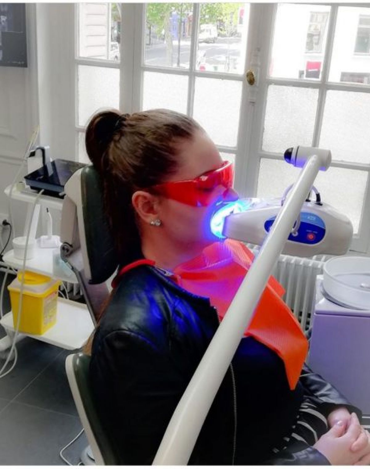 Blanchiment dentaire professionnel  à Roubaix (59) Par Camille - Estheca