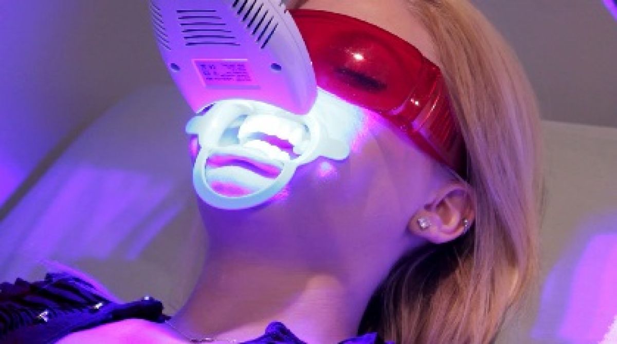 Blanchiment dentaire à Roubaix (59) Par Ghezala - Estheca
