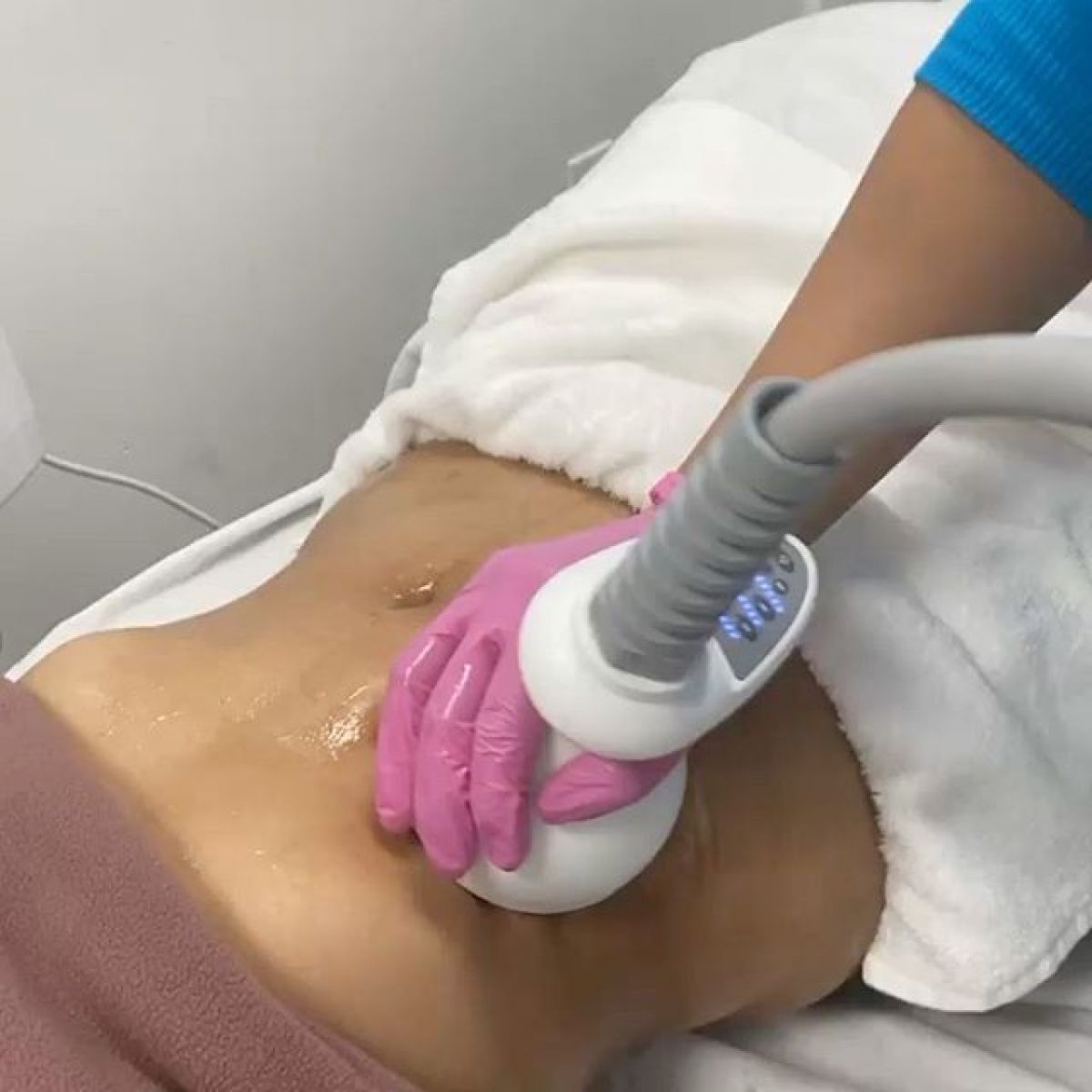 Radio fréquence / Lipocavitation à Savigny-sur-Orge (91) Par Virginie - Estheca