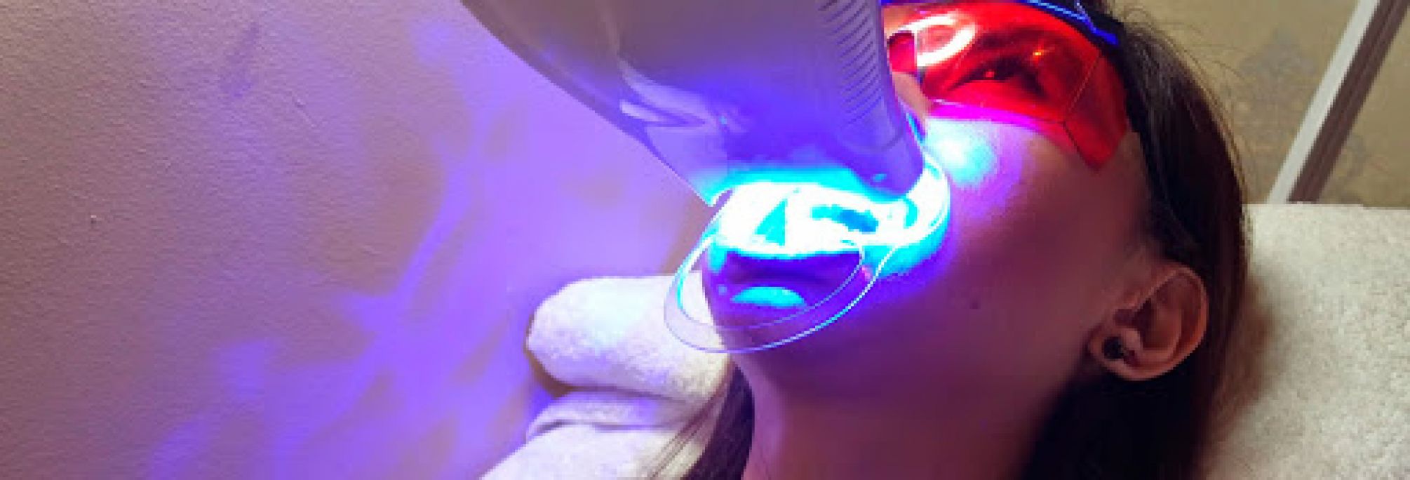 Blanchiment dentaire Pro à Cuise-la-Motte (60) Par Vanessa - Estheca