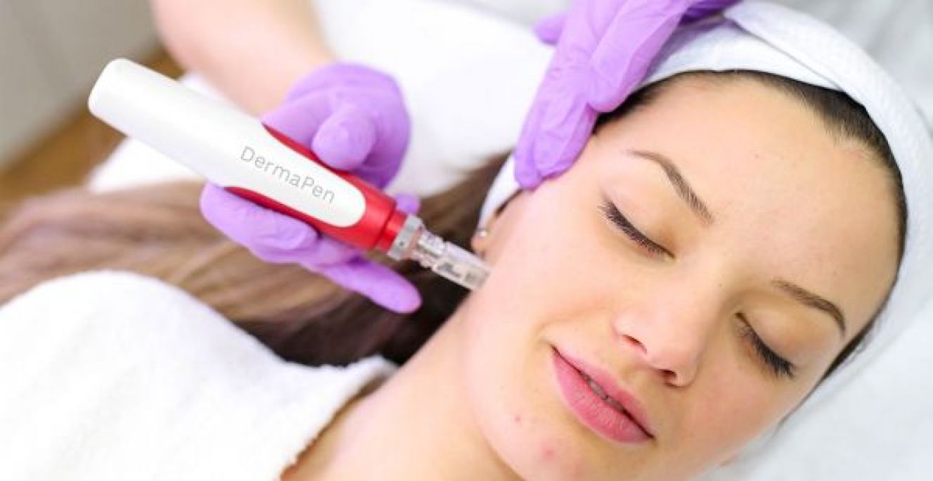 Microneedling (traces d'acné, imperfections...) à Tours (37) Par Nawel - Estheca