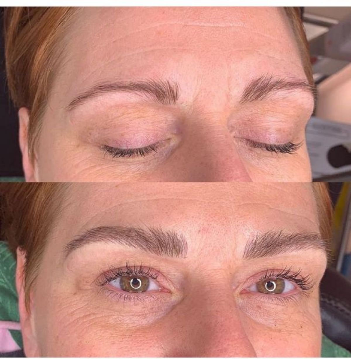 Microbalding  à La Madeleine (59) Par Fabienne - Estheca
