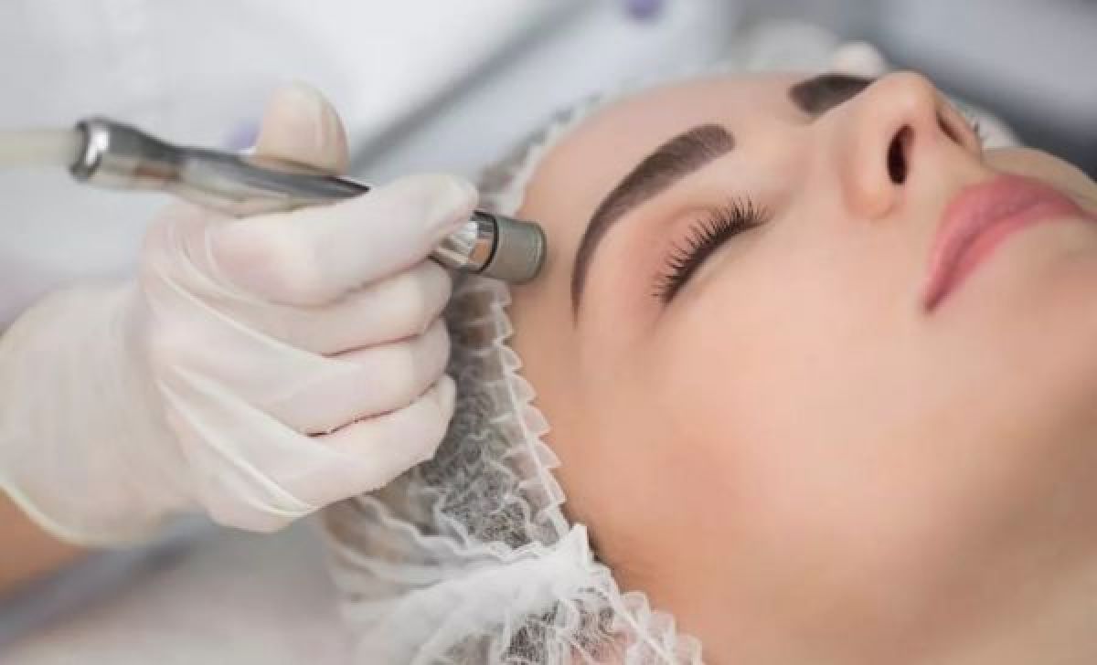 Microdermabrasion à Bezouce (30) Par Loucia - Estheca