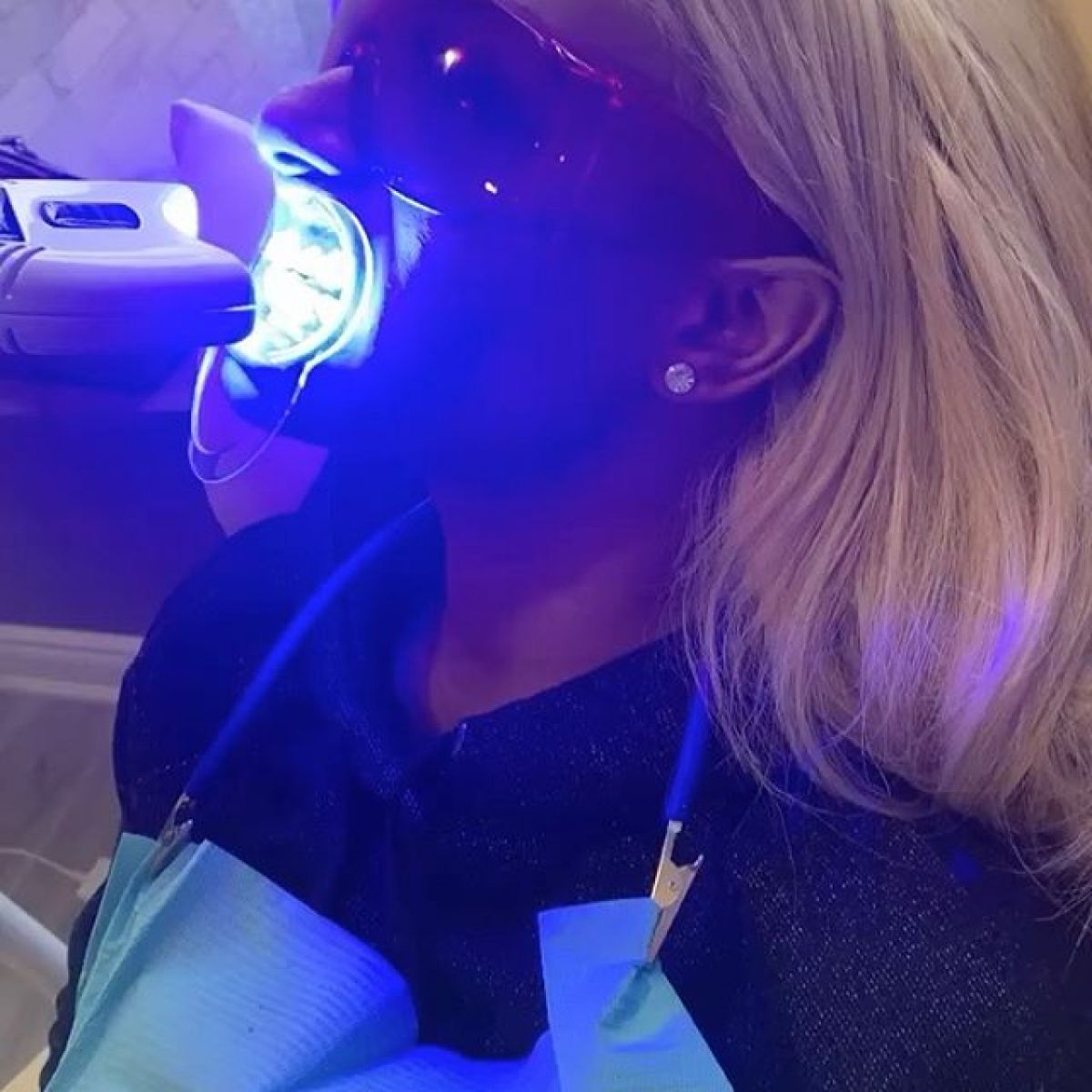 Blanchiment dentaire Professionnel à Tournefeuille (31) Par Manon - Estheca