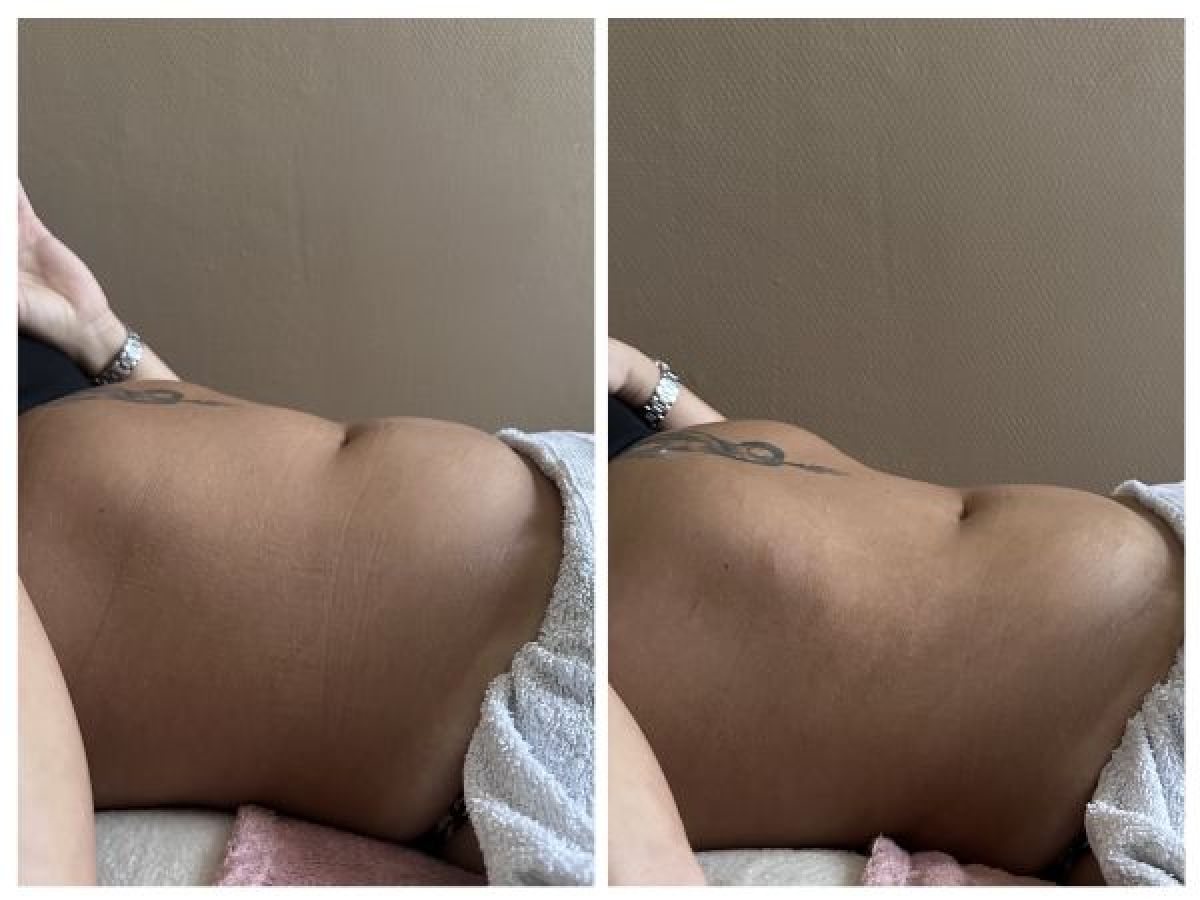 Drainage lymphatique brésilien corps entier à Ermont (95) Par Stephanie - Estheca