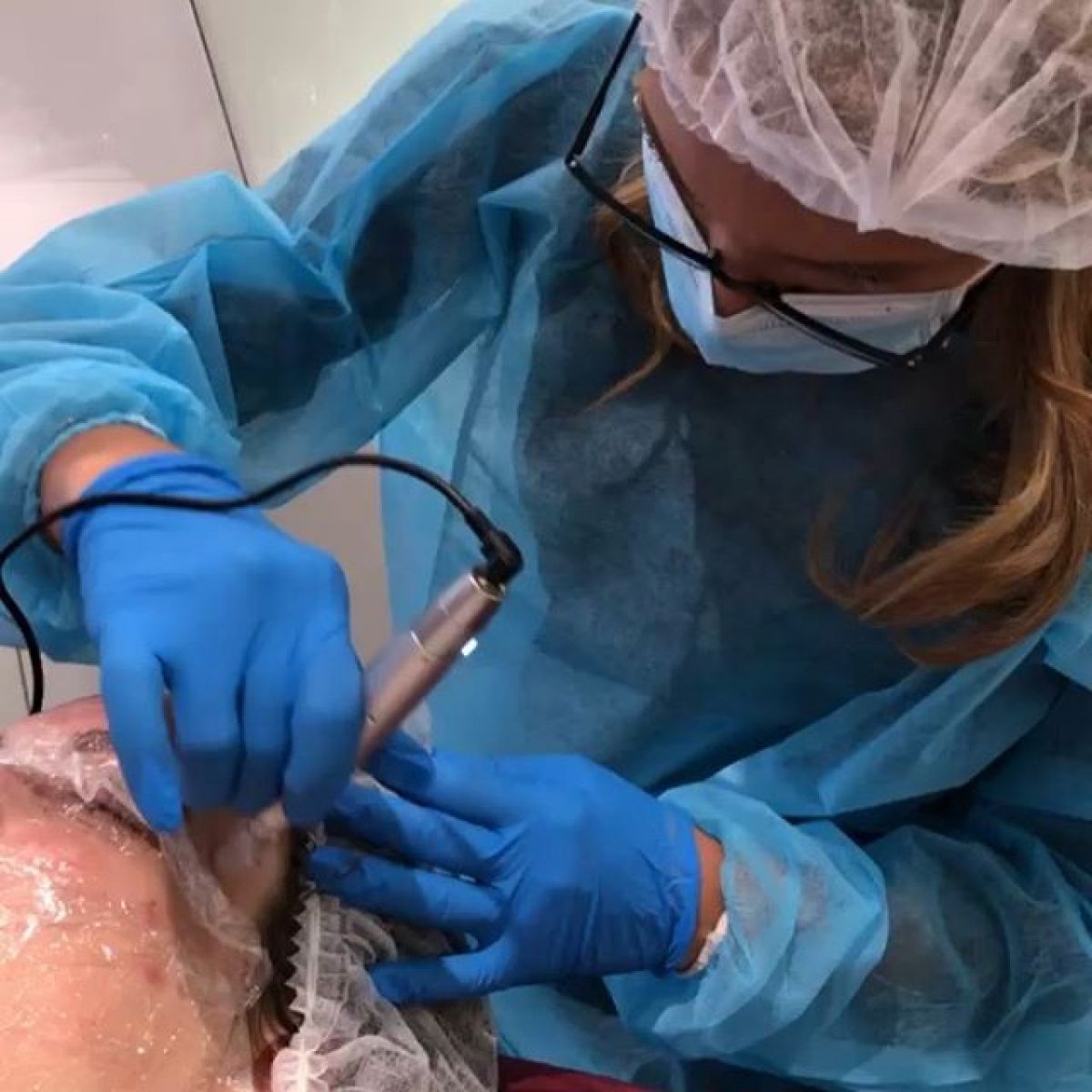 MicroNeedling BB Glow à L'Union (31) Par Angélique - Estheca