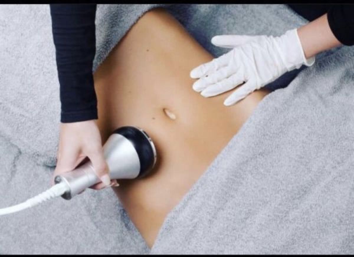 Lipocavitation / Radiofréquence à Tourcoing (59) Par Sarah - Estheca