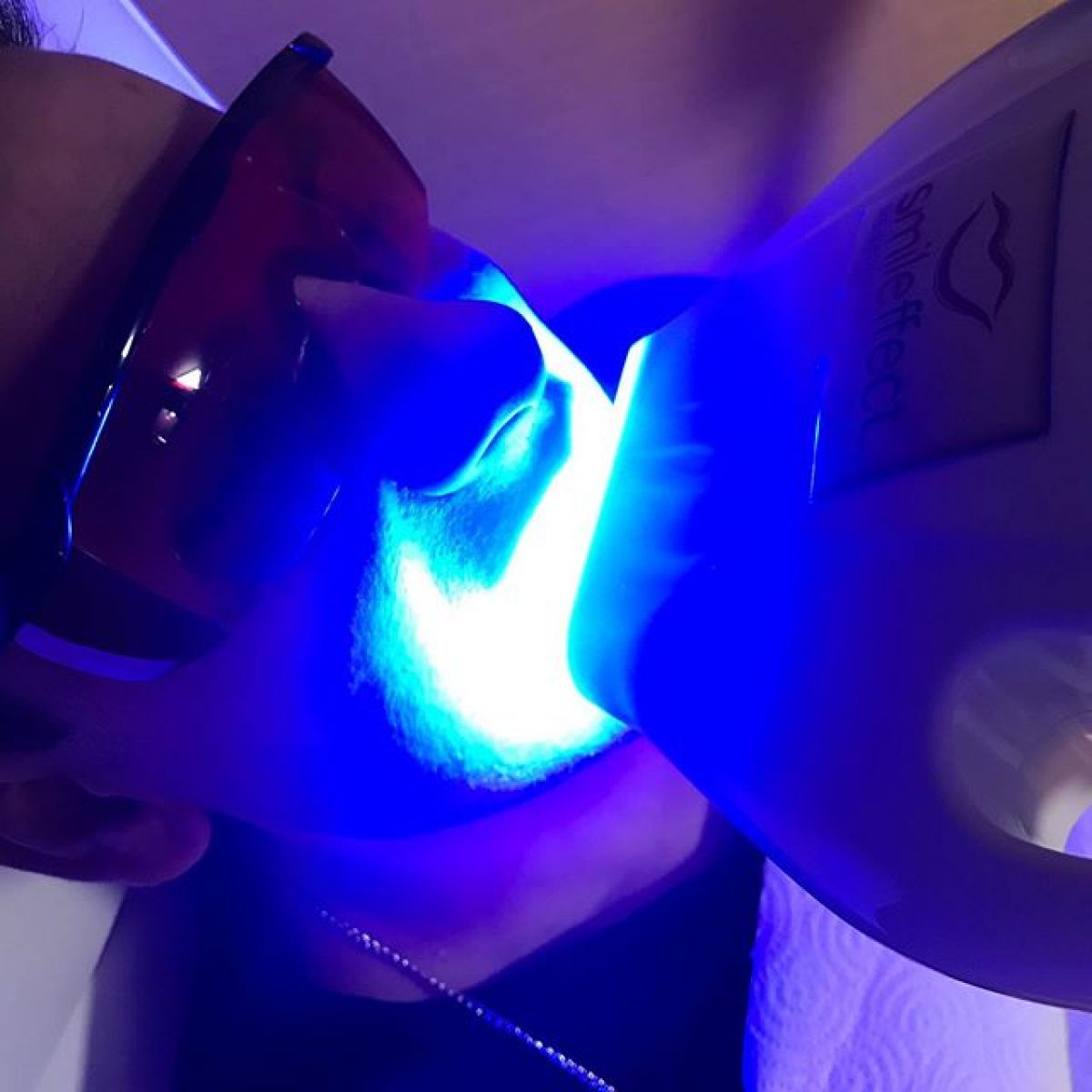 Blanchiment dentaire Pro à Nanterre (92) Par Émilie - Estheca
