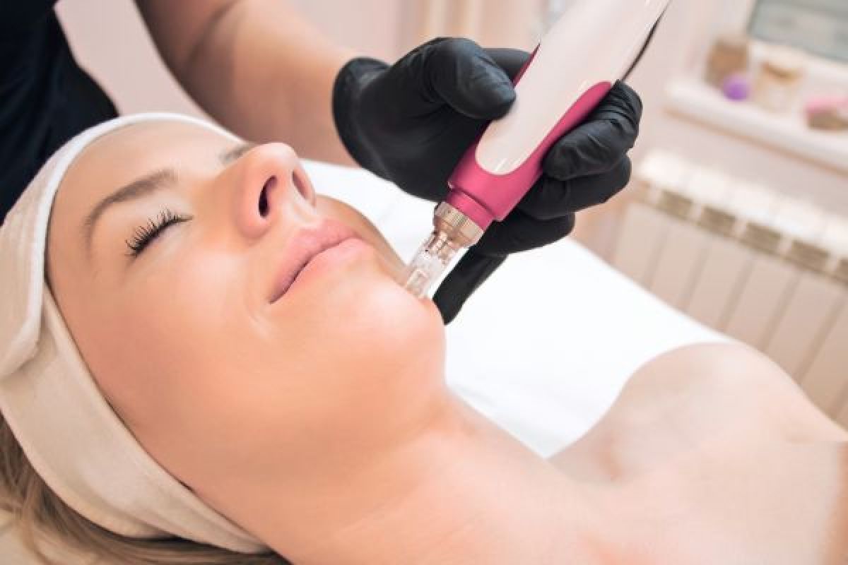 Microneedling/BB GLOW/Hydrated Face/Peeling à Combs-la-Ville (77) Par Mariette - Estheca