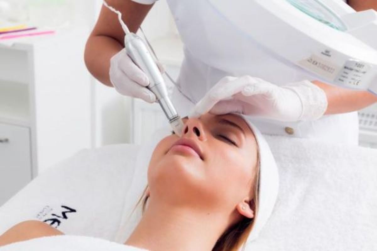 Microneedling BB GLOW à Rennes (35) Par Clémence - Estheca
