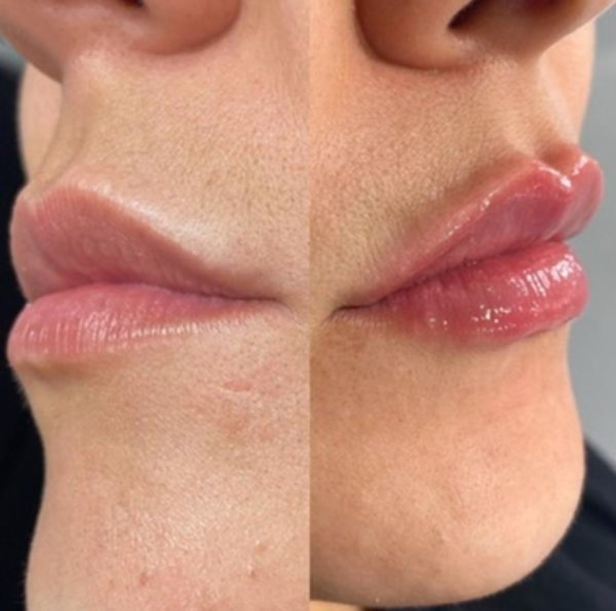 Russian Lips (Rides, Volumes, zones visages) à Crécy-la-Chapelle (77) Par Priscillia - Estheca