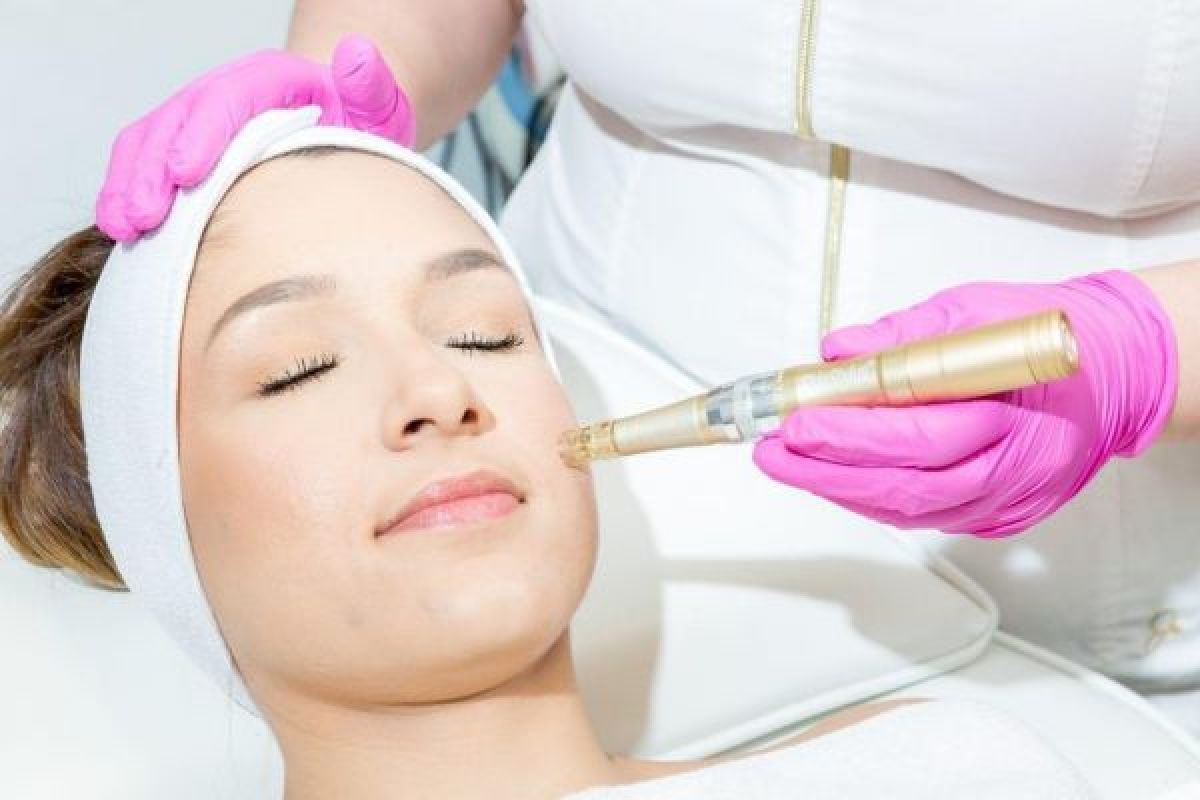 Microneedling/BB Glow  à Lille (59) Par Hajar - Estheca